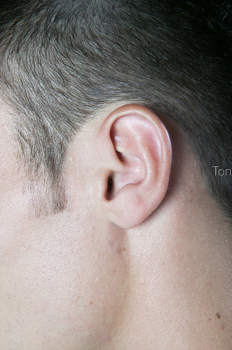 Oreja